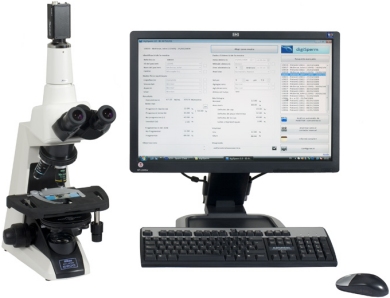 Sperm Analyser